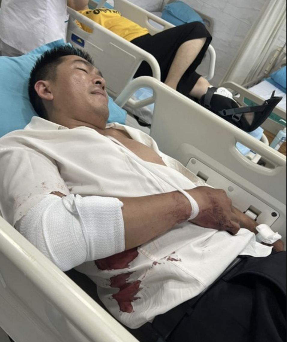Ông Luân được đưa đi cấp cứu và chuyển xuống Bệnh viện Chấn thương chỉnh hình TP Hồ Chí Minh để tiếp tục điều trị